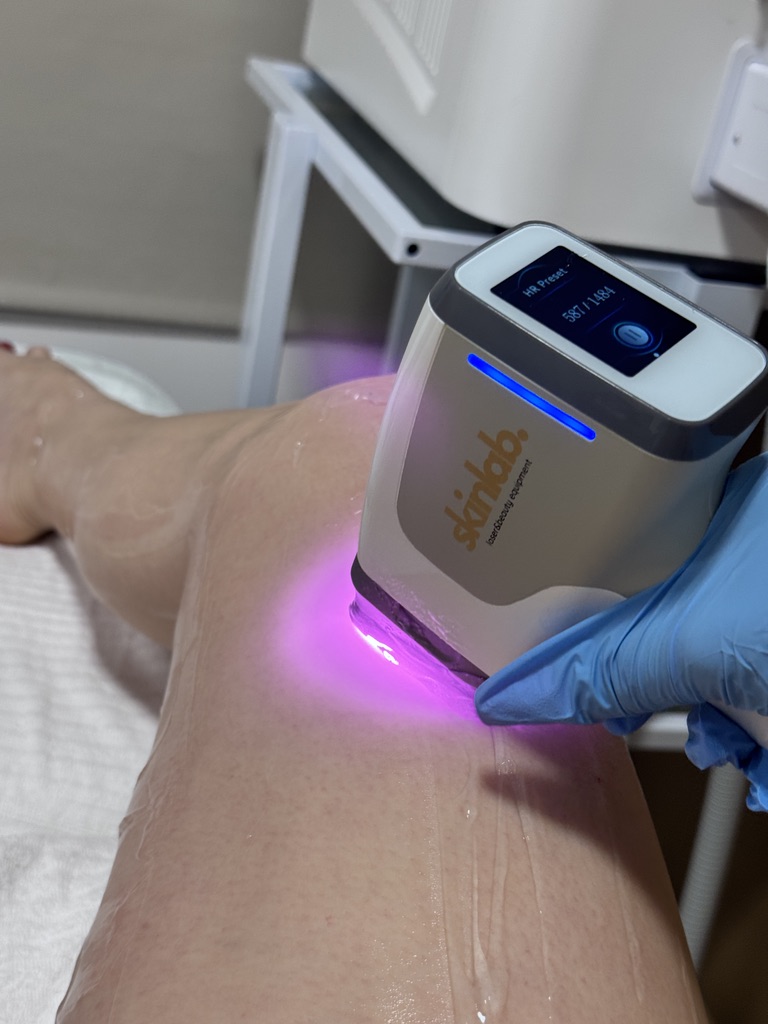 Fájdalommentes lézeres kezelés az Eden Laser Lounge-ban